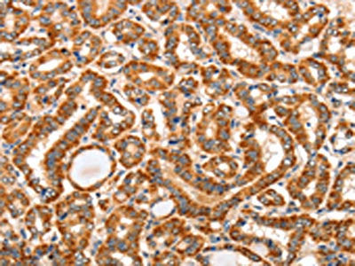 AIM2 Antibody