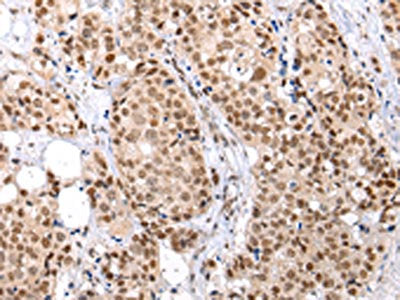 BRMS1 Antibody