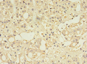 MYCBP Antibody