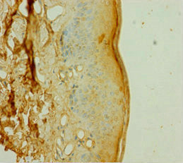 DOK1 Antibody