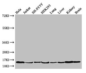 PAIP2 Antibody