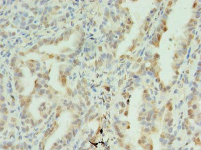 SDHC Antibody
