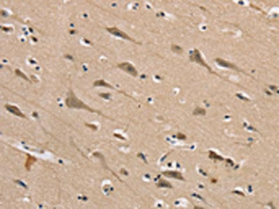 DLG2 Antibody