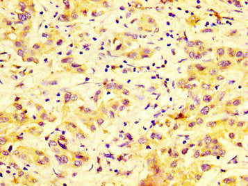 DUSP9 Antibody