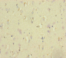NSMF Antibody