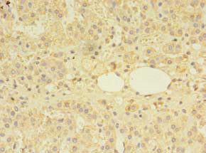 MTR Antibody