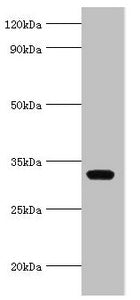 AGPAT1 Antibody