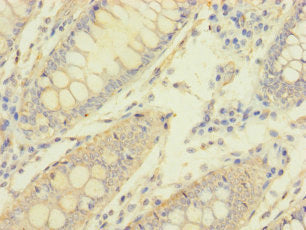 MACROD1 Antibody