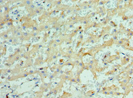 KIF2C Antibody