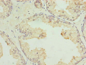 GPR21 Antibody