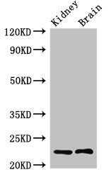 CHP1 Antibody