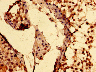 EPAS1 Antibody