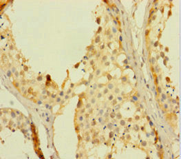 RHOXF2 Antibody