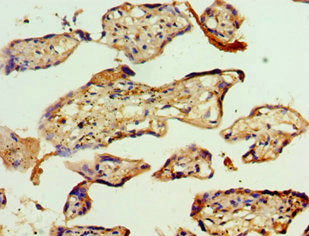 ACAT2 Antibody