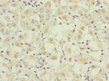 PARD6B Antibody