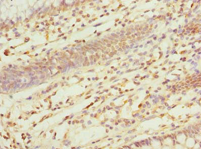 ZDHHC5 Antibody