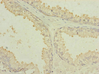 MTIF3 Antibody