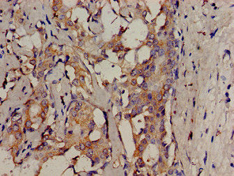 SRMS Antibody