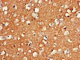 HMGB2 Antibody
