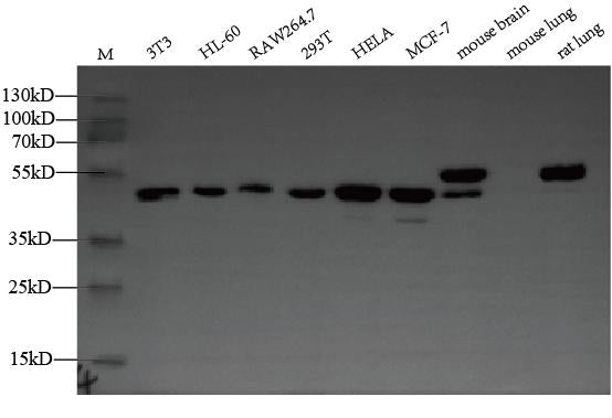 ZDHHC6 Antibody