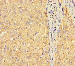 METTL7A Antibody