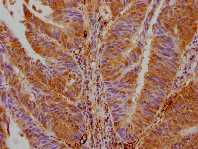 AKTIP Antibody