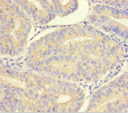 LMAN1L Antibody