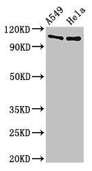 EML4 Antibody