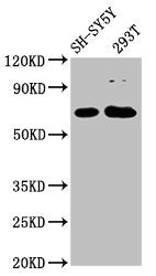 GALNT9 Antibody
