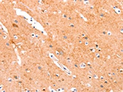 ANKZF1 Antibody