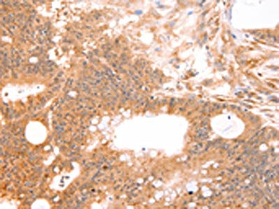 LTA Antibody