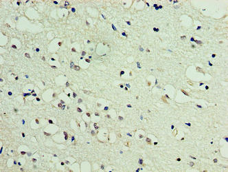 DBNDD2 Antibody