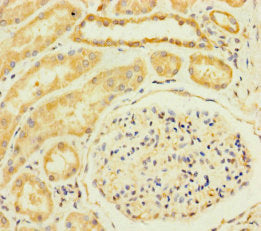 TM2D3 Antibody