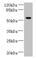 ADAT1 Antibody