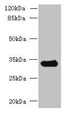 CCDC106 Antibody