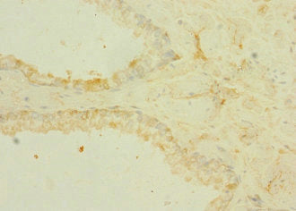 TRPM6 Antibody
