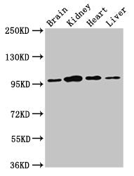 NAA15 Antibody
