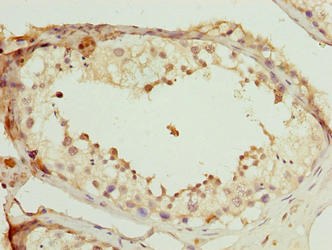 SCAPER Antibody