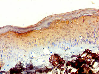 MRPL20 Antibody