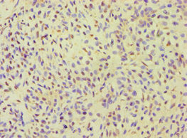 ALOXE3 Antibody