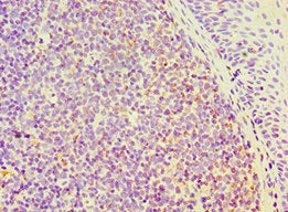 SEMA4C Antibody