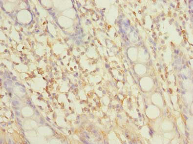 SLC6A16 Antibody
