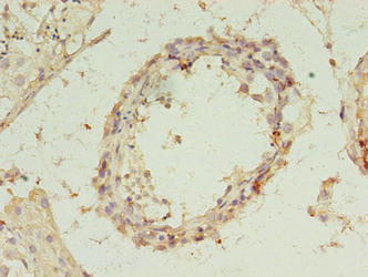 REXO4 Antibody