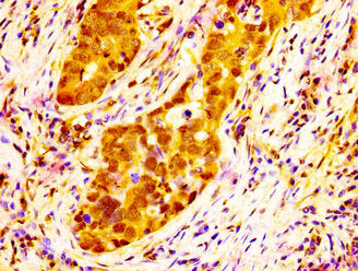 NAT10 Antibody