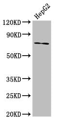 ABCG5 Antibody