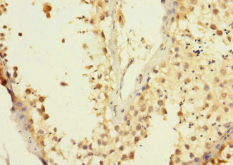 ADAM7 Antibody
