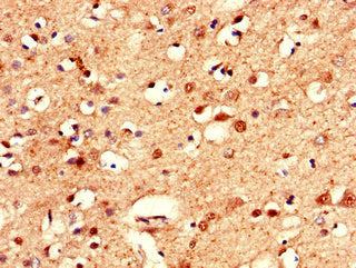 CLSTN2 Antibody
