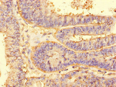 ALG2 Antibody