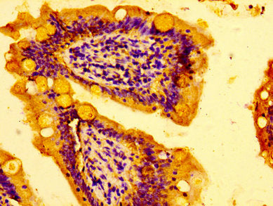 AZI2 Antibody