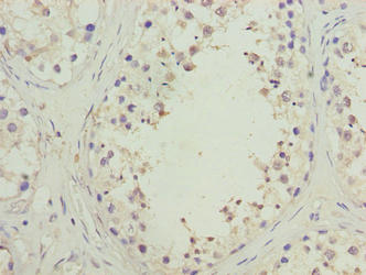 SPACA1 Antibody